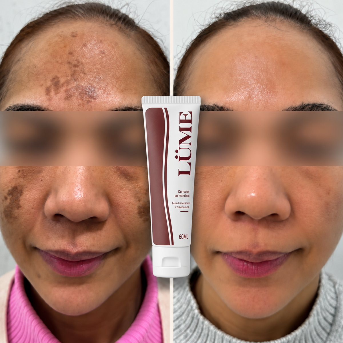 LÜME® Corrector de Manchas