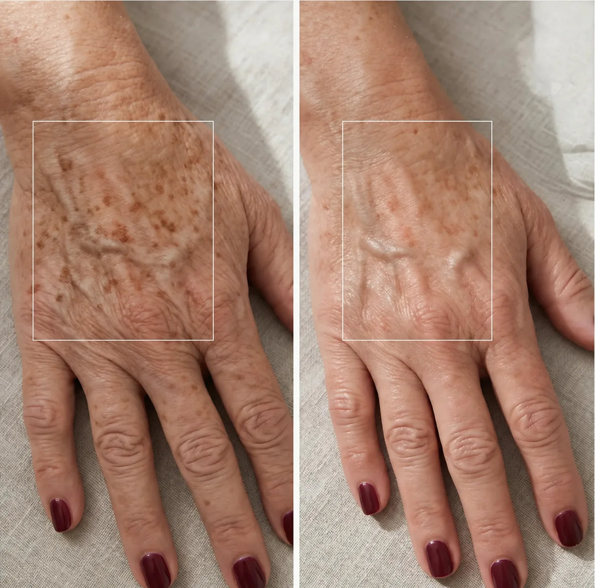 LÜME® Corrector de Manchas para Manos